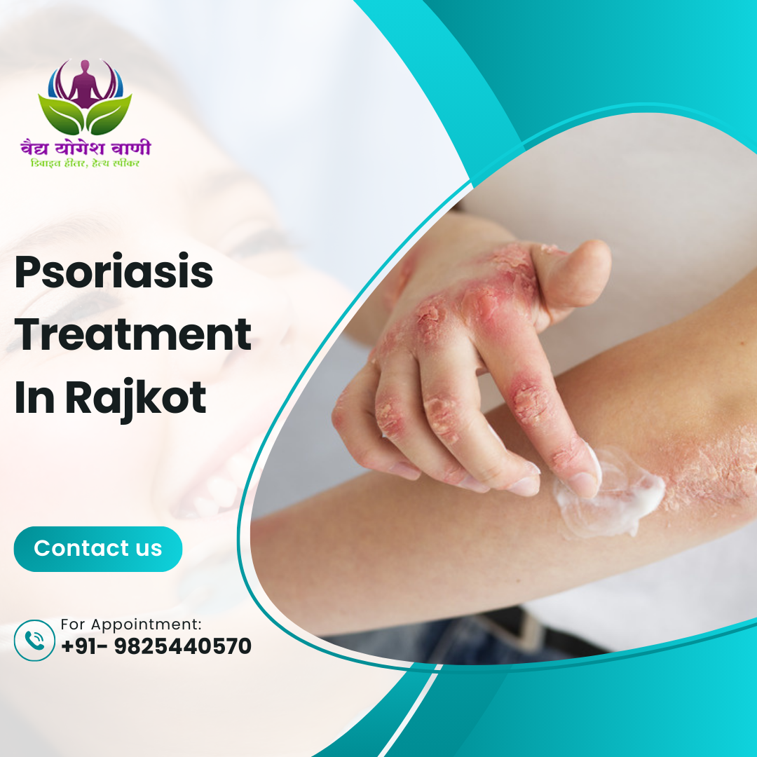 The Best Psoriasis Treatment in Rajkot: Find Relief with Vaidya Yogesh Vani